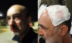 CHP İlçe Başkanının Babası Taşlı Saldırıya Uğradı: Saldırgan Gözaltına Alındı