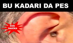 Kulağının içine uyuşturucu madde saklayan şahıs yakalandı